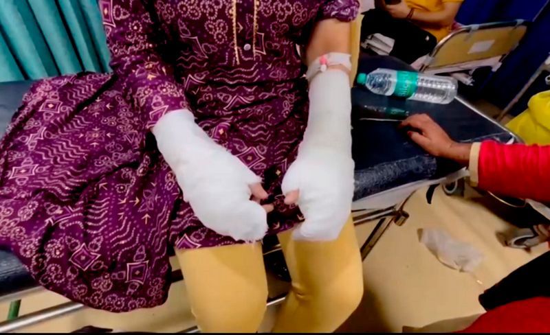 ਦਿੱਲੀ ਤੇਜ਼ਾਬ ਹਮਲਾ: ਪਿਓ-ਧੀ ਨੇ ਟਾਇਲਟ ਕਲੀਨਰ ਵਰਤ ਕੇ ਘੜੀ ਤੇਜ਼ਾਬ ਹਮਲੇ ਦੀ ਝੂਠੀ ਕਹਾਣੀ